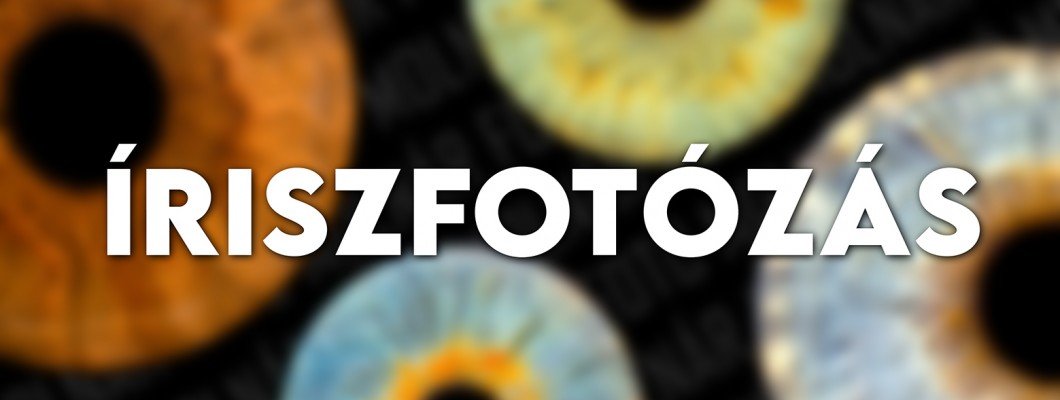 Íriszfotózás