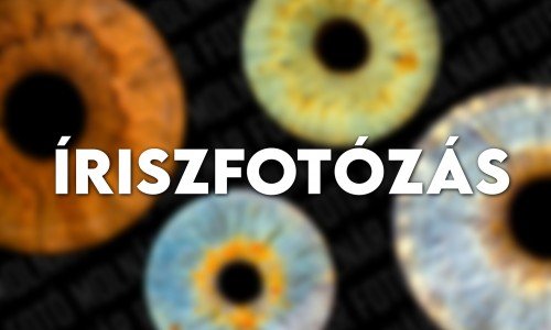 Íriszfotózás Íriszfotózás